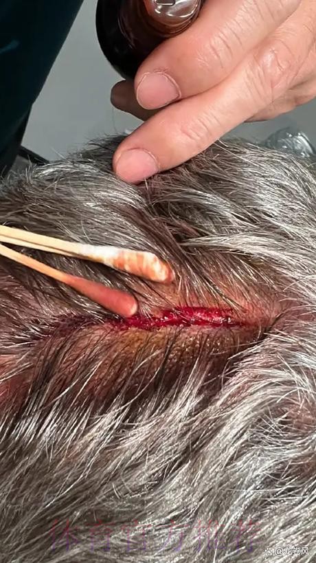 安帅曾表示希望球员健康归来 但皇马已有5人受伤 安帅曾表示希望球员健康归来 但皇马已有5人受伤